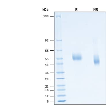 2 μg/lane of Recombinant Human IL-13 R alpha 2 His-tag Protein (Catalog # 11562-IR) was resolved with SDS-PAGE under reducing (R) and non-reducing (NR) conditions and visualized by Coomassie® Blue staining, showing bands at 53-58 kDa, under reducing conditions.