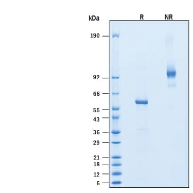 2 μg/lane of Recombinant Mouse R‑Spondin 1 Fc Chimera Protein (Catalog # 11566-RS) was resolved with SDS-PAGE under reducing (R) and non-reducing (NR) conditions and visualized by Coomassie® Blue staining, showing bands at SDS-PAGE 57-63 kDa and 110‑130 kDa, respectively.