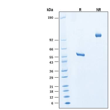 2 μg/lane of Recombinant Mouse R‑Spondin 2 Fc Chimera Protein (Catalog # 11567-RS) was resolved with SDS-PAGE under reducing (R) and non-reducing (NR) conditions and visualized by Coomassie® Blue staining, showing bands at 52-63 kDa and 104-130 kDa, respectively.