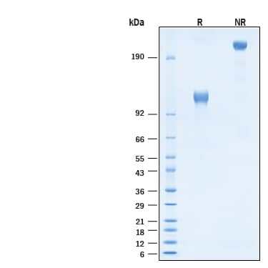 2 μg/lane of Recombinant Human IFN-alpha/beta R1 Fc Chimera Protein (Catalog # 11574-AB) was resolved with SDS-PAGE under reducing (R) and non-reducing (NR) conditions and visualized by Coomassie® Blue staining, showing bands at 105-120 kDa and 210-240 kDa, respectively.