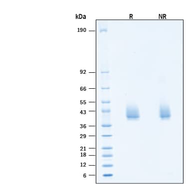 2 μg/lane of Recombinant Human IFN-gamma R2 His-tag Protein (Catalog # 11576-GR) was resolved with SDS-PAGE under reducing (R) and non-reducing (NR) conditions and visualized by Coomassie® Blue staining, showing bands at 38-42 kDa, under reducing conditions.