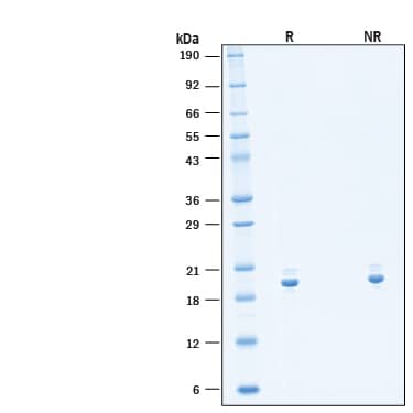 2 μg/lane of Recombinant Mouse IL‑11 Protein (Catalog # 11585-IL) was resolved with SDS-PAGE under reducing (R) and non-reducing (NR) conditions and visualized by Coomassie® Blue staining, showing bands at 20 kDa under reducing conditions.