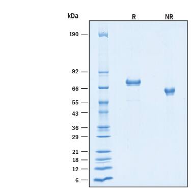 2 μg/lane of Recombinant Human C1qR1/CD93 His-tag Protein (Catalog # 11587-CD) was resolved with SDS-PAGE under reducing (R) and non-reducing (NR) conditions and visualized by Coomassie® Blue staining, showing bands at 65-80 kDa, under reducing conditions.