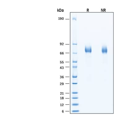 2 μg/lane of Recombinant Human Complement Component C1rLP HA-tag His-tag Protein (Catalog # 11614-CP) was resolved with SDS-PAGE under reducing (R) and non-reducing (NR) conditions and visualized by Coomassie® Blue staining, showing bands at 70‑76 kDa, under reducing conditions.