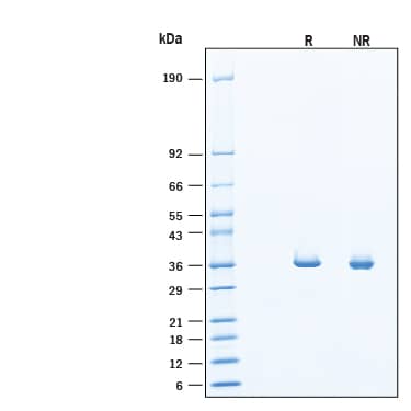 2 μg/lane of Recombinant Human MDH1 His-tag (Catalog # 11632-MH) was resolved with SDS-PAGE under reducing (R) and non-reducing (NR) conditions and visualized by Coomassie® Blue staining, showing bands at 35-38 kDa, under reducing conditions.