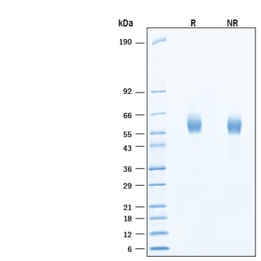 2 μg/lane of Recombinant Human LIPA HA-tag His-tag (Catalog # 11633-LA) was resolved with SDS-PAGE under reducing (R) and non-reducing (NR) conditions and visualized by Coomassie® Blue staining, showing bands at 55-67 kDa, under reducing conditions.