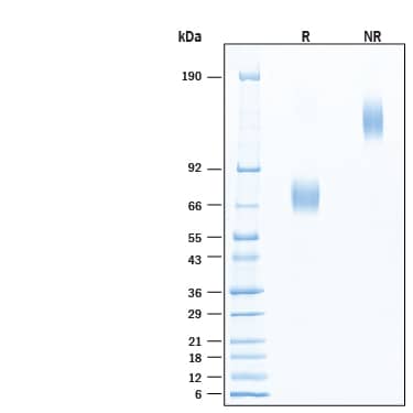 2 μg/lane of Recombinant Mouse Fc epsilon  RI alpha  mFc Chimera Protein (Catalog # 11646-FC) was resolved with SDS-PAGE under reducing (R) and non-reducing (NR) conditions and visualized by Coomassie® Blue staining, showing bands at 67-73 kDa and 130-150 kDa, respectively.