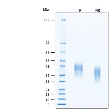 2 μg/lane of Recombinant Human Fc gamma RIIIB/CD16b/NA1 His‑tag Protein (Catalog # 11652-FC) was resolved with SDS-PAGE under reducing (R) and non-reducing (NR) conditions and visualized by Coomassie® Blue staining, showing bands at 33‑45 kDa, under reducing conditions.