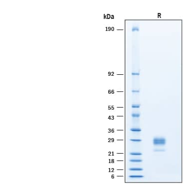 2 μg/lane of Recombinant Mouse IL‑34 His-tag Protein (Catalog # 11653-ML) was resolved with SDS-PAGE under reducing (R) condition and visualized by Coomassie® Blue staining, showing bands at 21-32 kDa.