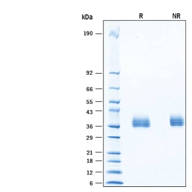 2 μg/lane of Recombinant Human PPT1 HA-tag His-tag Protein (Catalog # 11661-PT) was resolved with SDS-PAGE under reducing (R) and non-reducing (NR) conditions and visualized by Coomassie® Blue staining, showing bands at 33-40 kDa, under reducing conditions.