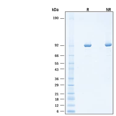 2 μg/lane of Recombinant E. coli T7 phage RNA polymerase His-tag Protein (Catalog # 11662-T7) was resolved with SDS-PAGE under reducing (R) and non-reducing (NR) conditions and visualized by Coomassie® Blue staining, showing bands at 89-98 kDa, under reducing conditions.