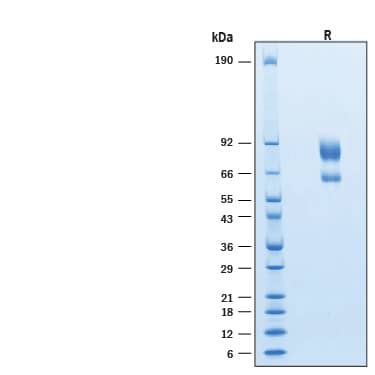 2 μg/lane of Recombinant Human IL-2R beta Fc/IL-2R gamma Fc Heterodimer Protein (Catalog # 11686-2B) was resolved with SDS-PAGE under reducing (R) condition and visualized by Coomassie® Blue staining, showing bands at 62-68 kDa (IL-2R beta) & 85-93 kDa (IL-2R gamma).