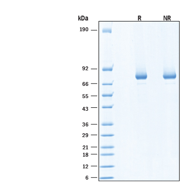 2 μg/lane of Recombinant Human JAK1 kinase domain His-tag (Catalog # 11738-J1) was resolved with SDS-PAGE under reducing (R) and non-reducing (NR) conditions and visualized by Coomassie® Blue staining, showing bands at 75-89 kDa, under reducing conditions.