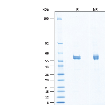 2 μg/lane of Recombinant Human GSK-3 beta His-tag (Catalog # 11739-KS) was resolved with SDS-PAGE under reducing (R) and non-reducing (NR) conditions and visualized by Coomassie® Blue staining, showing bands at 55-64 kDa, under reducing conditions.