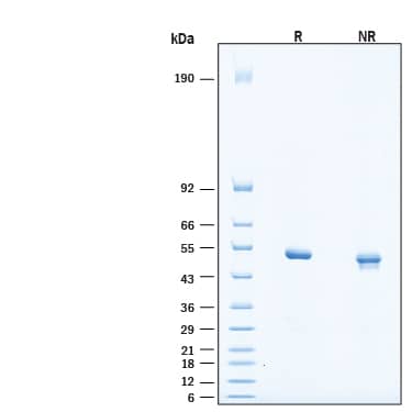 2 μg/lane of Recombinant Human Pancreatic Lipase/PNLIP HA-tag His-tag (Catalog # 11773-PL) was resolved with SDS-PAGE under reducing (R) and non-reducing (NR) conditions and visualized by Coomassie® Blue staining, showing bands at 50-55 kDa, under reducing conditions.