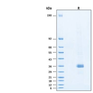 SDS-PAGE Apolipoprotein E/ApoE [Unconjugated]