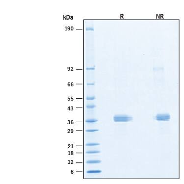 2 μg/lane of Recombinant Human Apolipoprotein E3/ApoE3 Protein (Catalog # 11781-AE) was resolved with SDS-PAGE under reducing (R) and non-reducing (NR) conditions and visualized by Coomassie® Blue staining, showing bands at 34-40 kDa, under reducing conditions.