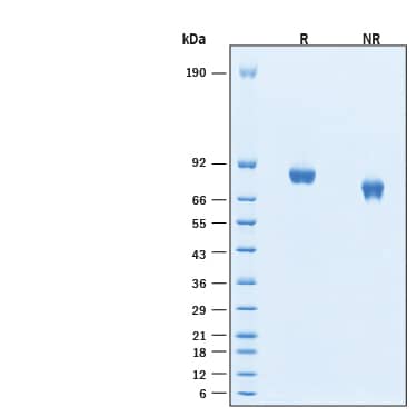 2 μg/lane of Recombinant Human IGF-II R/IGF2R His-tag Protein (Catalog # 11783-GR) was resolved with SDS-PAGE under reducing (R) and non-reducing (NR) conditions and visualized by Coomassie® Blue staining, showing bands at 78-89 kDa, under reducing conditions.