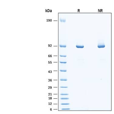 2 μg/lane of Recombinant Human Muscle Glycogen Phosphorylase His-tag (Catalog # 11786-PM) was resolved with SDS-PAGE under reducing (R) and non-reducing (NR) conditions and visualized by Coomassie® Blue staining, showing bands at 86-96 kDa, under reducing conditions.