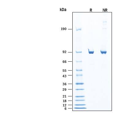 2 μg/lane of Recombinant Human Liver GlycogenPhosphorylase His-tag (Catalog # 11787-PL) was resolved with SDS-PAGE under reducing (R) and non-reducing (NR) conditions and visualized by Coomassie® Blue staining, showing bands at 85-94 kDa, under reducing conditions.