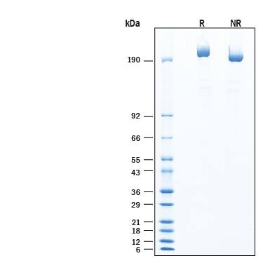 2 μg/lane of Recombinant Human Fatty Acid Synthase/FASN His-tag (Catalog # 11788-FS) was resolved with SDS-PAGE under reducing (R) and non-reducing (NR) conditions and visualized by Coomassie® Blue staining, showing bands at 234-258 kDa, under reducing conditions.