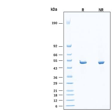 2 μg/lane of Recombinant Human Protein Kinase SRC His-tag (Catalog # 11800-KS) was resolved with SDS-PAGE under reducing (R) and non-reducing (NR) conditions and visualized by Coomassie® Blue staining, showing bands at 51-57 kDa, under reducing conditions.