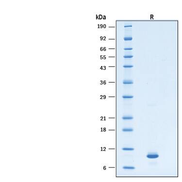 2 μg/lane of Recombinant Human S100A14 His-tag Protein (Catalog # 11801-SA) was resolved with SDS-PAGE under reducing (R) condition and visualized by Coomassie® Blue staining, showing bands at 8-10 kDa.