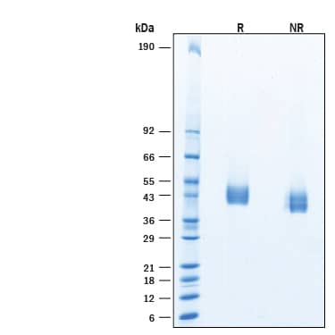 SDS-Page Decorin [Unconjugated]