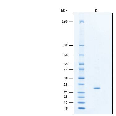 2 μg/lane of Recombinant Human SOCS‑1 His-tag Protein (Catalog # 11815-S1) was resolved with SDS-PAGE under reducing (R) condition and visualized by Coomassie® Blue staining, showing bands at 23-27 kDa.