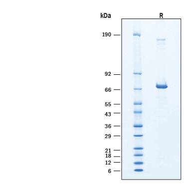 2 μg/lane of Recombinant Human p53 His-tag Protein (Catalog # 11816-TP) was resolved with SDS-PAGE under reducing (R) condition and visualized by Coomassie® Blue staining, showing bands at 66-73 kDa.