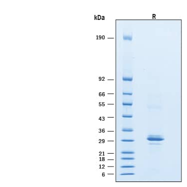 2 μg/lane of Recombinant Human STING/TMEM173 His-tag Protein (Catalog # 11821-ST) was resolved with SDS-PAGE under reducing (R) condition and visualized by Coomassie® Blue staining, showing bands at 28-35 kDa.