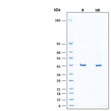 2 μg/lane of Recombinant Human Active MEK2 Kinase His-tag (Catalog # 11825-ME) was resolved with SDS-PAGE under reducing (R) and non-reducing (NR) conditions and visualized by Coomassie® Blue staining, showing bands at 43-47 kDa, under reducing conditions.