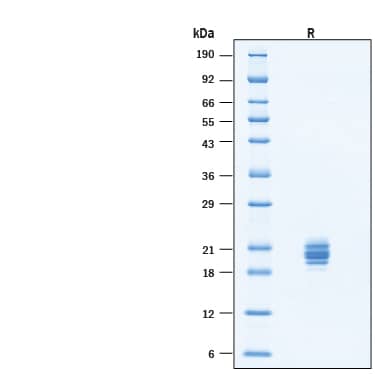 2 μg/lane of Recombinant Human APOC3 His-tag Protein (Catalog # 11826-AC) was resolved with SDS-PAGE under reducing (R) condition and visualized by Coomassie® Blue staining, showing bands at 19-23 kDa.