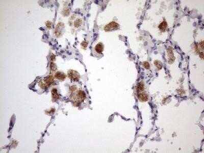 Immunohistochemistry: 12-Lipoxygenase Antibody (OTI1C3) - Azide and BSA Free [NBP2-70165] - Analysis of Human lung tissue. (Heat-induced epitope retrieval by 1 mM EDTA in 10mM Tris, pH8.5, 120C for 3min)