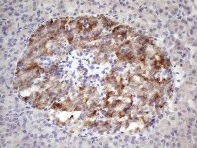 Immunohistochemistry: 12-Lipoxygenase Antibody (OTI1C3) - Azide and BSA Free [NBP2-70165] - Analysis of Human pancreas tissue. (Heat-induced epitope retrieval by 1 mM EDTA in 10mM Tris, pH8.5, 120C for 3min)