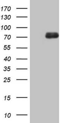 Western Blot: 12-Lipoxygenase Antibody (OTI1C3) - Azide and BSA Free [NBP2-70165] - Analysis of HEK293T cells were transfected with the pCMV6-ENTRY control (Left lane) or pCMV6-ENTRY 12-Lipoxygenase.
