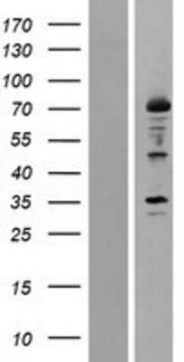 Western Blot 12-Lipoxygenase Overexpression Lysate