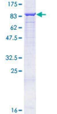 Western Blot Recombinant Human 12-Lipoxygenase GST (N-Term) Protein