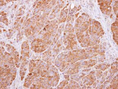 Immunohistochemistry-Paraffin: 14-3-3 beta/alpha Antibody [NBP1-33454] - Paraffin-embedded SW480 xenograft, using antibody at 1:500 dilution.