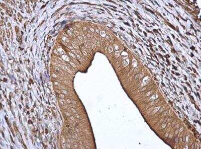 Immunohistochemistry-Paraffin: 14-3-3 beta/alpha Antibody [NBP1-33454] -  Rat cervix. 14-3-3 beta antibody [N1C2] diluted at 1:500. Antigen Retrieval: Citrate buffer, pH 6.0, 15 min. 