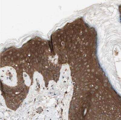 Immunohistochemistry-Paraffin: 14-3-3 beta/alpha Antibody [NBP1-80611] -  Staining of human skin shows moderate to strong cytoplasmic positivity in epidermal cells.