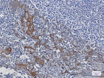 Immunohistochemistry-Paraffin: 14-3-3 beta/alpha Antibody (S07-1A8) [NBP3-14905] - Immunohistochemistry of 14-3-3 beta/alpha in paraffin-embedded Human tonsil using 14-3-3 beta/alpha Rabbit mAb at dilution 1/100