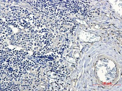 Immunohistochemistry: 14-3-3 beta/alpha Antibody (S08-4A7) [NBP3-14906] - Immunohistochemical of 14-3-3 beta/alpha in Human tonsil tissue using 14-3-3 beta/alpha antibody at dilution 1/50