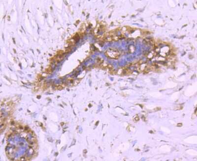 Immunohistochemistry-Paraffin: 14-3-3 beta/alpha Antibody (SD0837) [NBP2-67833] - Analysis of paraffin-embedded human breast tissue using anti-14-3-3 alpha+beta antibody. Counter stained with hematoxylin.