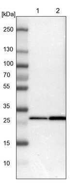 Western Blot: 14-3-3 beta/alpha Antibody [NBP1-80611] - Lane 1: NIH-3T3 cell lysate (Mouse embryonic fibroblast cells). Lane 2: NBT-II cell lysate (Rat Wistar bladder tumor cells).