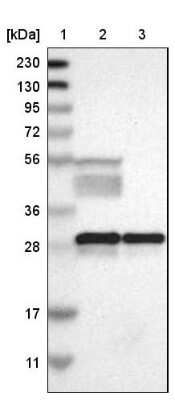 Western Blot: 14-3-3 beta/alpha Antibody [NBP1-80611] - Lane 1: Marker  [kDa] 230, 130, 95, 72, 56, 36, 28, 17, 11.  Lane 2: Human cell line RT-4.  Lane 3: Human cell line U-251MG sp