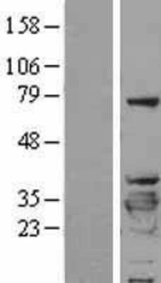 Western Blot 14-3-3 beta/alpha Overexpression Lysate