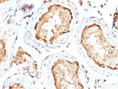 Immunohistochemistry-Paraffin: 14-3-3 epsilon Antibody (CPTC-YWHAE-1) - Azide and BSA Free [NBP2-79944] - Formalin-fixed, paraffin-embedded human Testis stained with 14-3-3E Mouse Monoclonal Antibody (CPTC-YWHAE-1).