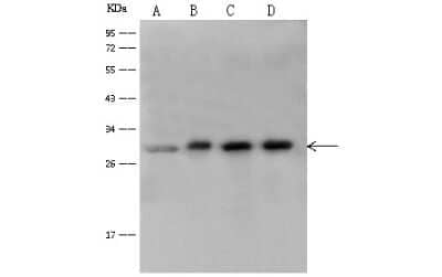 Western Blot: 14-3-3 eta Antibody [NBP2-99490] - Anti-14-3-3 eta rabbit polyclonal antibody at 1:500 dilution. Lane A: Jurkat Whole Cell Lysate. Lane B: A375 Whole Cell Lysate. Lane C: 293T Whole Cell Lysate. Lane D: K562 Whole Cell Lysate. Lysates/proteins at 30 ug per lane. Secondary Goat Anti-Rabbit IgG (H+L)/HRP at 1/10000 dilution. Developed using the ECL technique. Performed under reducing conditions. Predicted band size: 28 kDa. Observed band size: 28 kDax