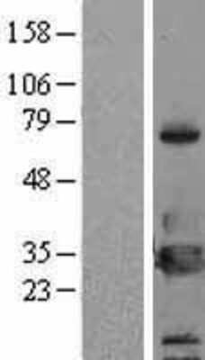 Western Blot 14-3-3 eta Overexpression Lysate